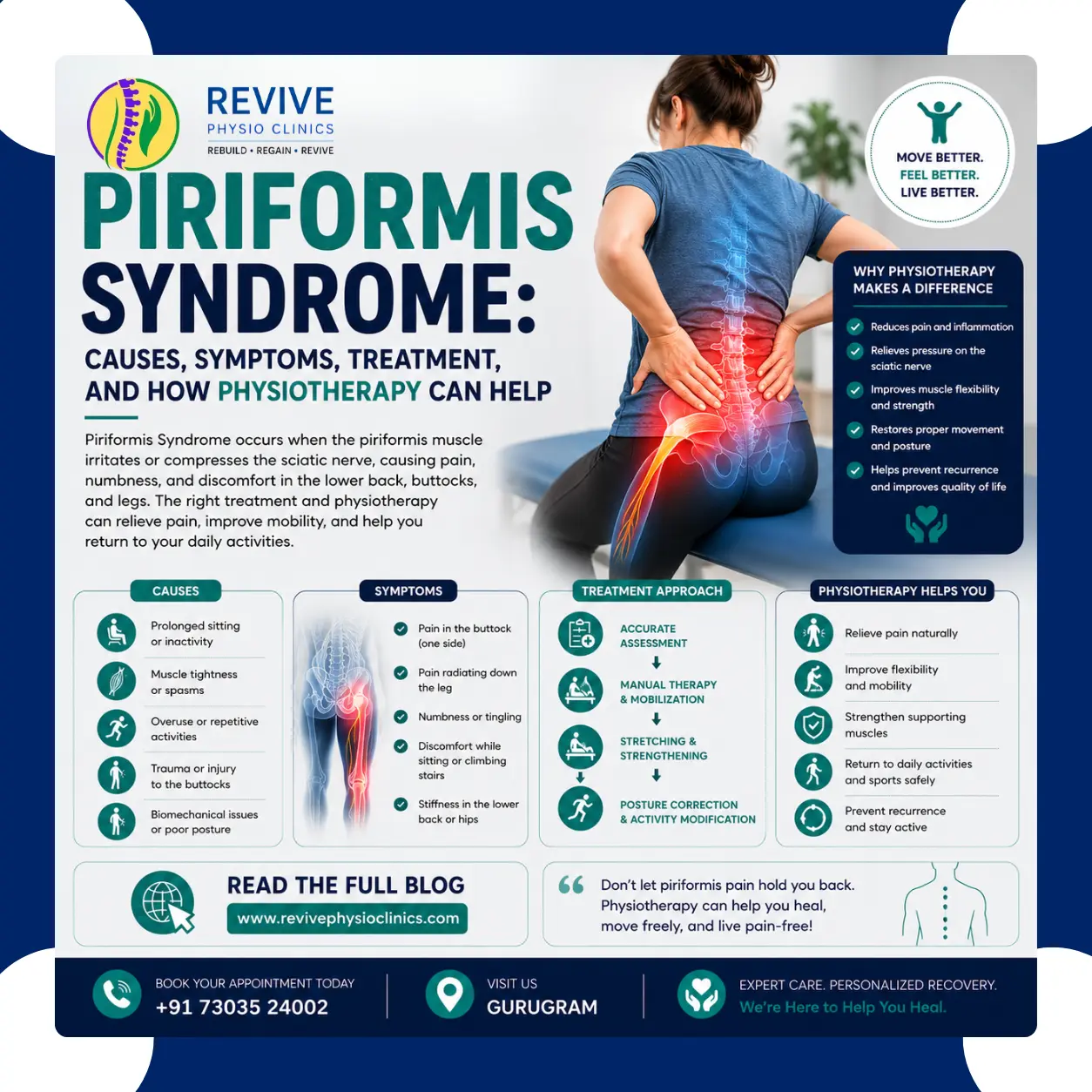 Piriformis Syndrome